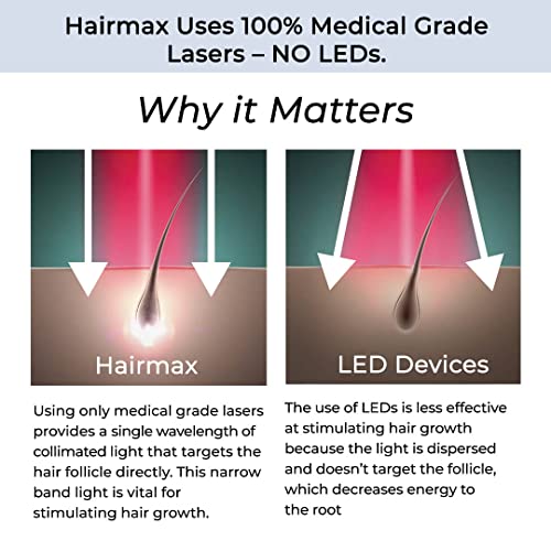 Hairmax LaserBand 82 - Hair Growth and Regrowth Treatment - Restores Natural Hair Cycle - Home-Use Medical Device With Medical Grade Lasers