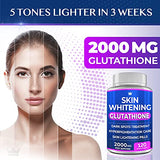 3 Pack Glutathione Whitening Pills - 120 Capsules 2000mg Glutathione - Effective Skin Lightening Supplement - Dark Spots, Melasma & Acne Scar Remover, Hyperpigmentation Treatment - Anti-Aging Antioxidant