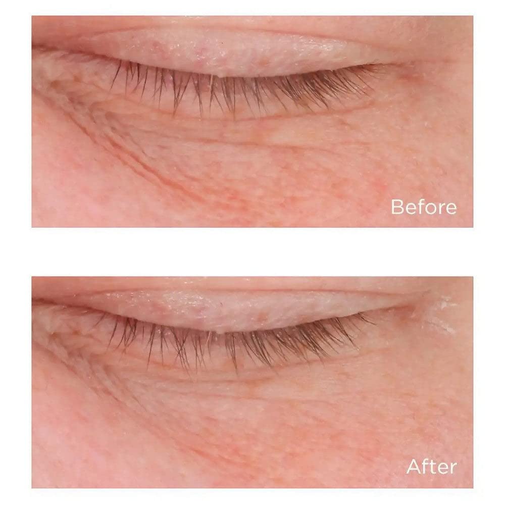 Cold Plasma Plus+ Advanced Eye Cream, 0.5 fl. oz.