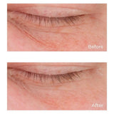 Cold Plasma Plus+ Advanced Eye Cream, 0.5 fl. oz.