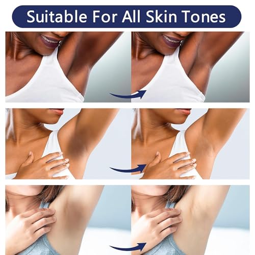 Skin Lightening Cream Skin Bleaching Cream Whitening Cream For Body Intimate Area, Private Parts, Underarm, Knees, Elbows, Inner Thigh, Bikini Areas
