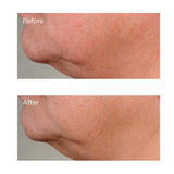 High Potency Growth Factor Firming & Lifting Serum, 2 fl. oz.