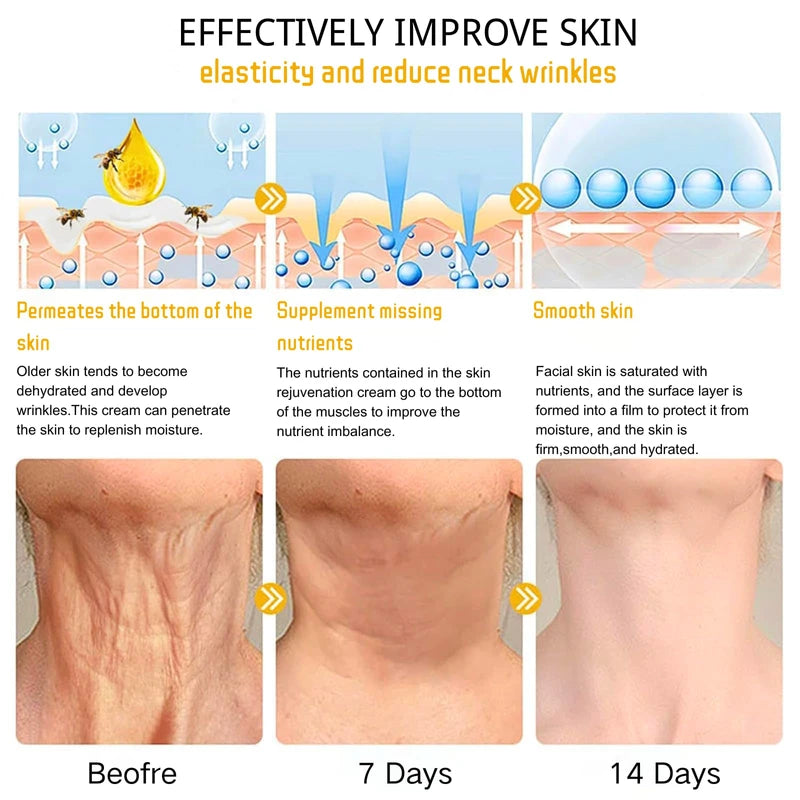 Bee Lift Anti Aging Firming Body Cream, Bee Venom Wrinkle Removal Cream, Collagen Firming Body Lotion, Neck Firming Cream For Loose Skin, Skin Tightening Cream Body, Restore Elasticity, Hydration