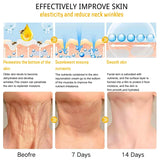 Bee Lift Anti Aging Firming Body Cream, Bee Venom Wrinkle Removal Cream, Collagen Firming Body Lotion, Neck Firming Cream For Loose Skin, Skin Tightening Cream Body, Restore Elasticity, Hydration