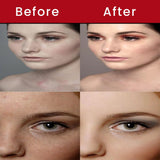 Bio Mystery Retinol Gel 0.025 Vitamin A Repairs Fine Lines & Wrinkles, Scar Treatment, Sun Spots, Anti-Aging Formula (35 Gram / 1.23 Oz)