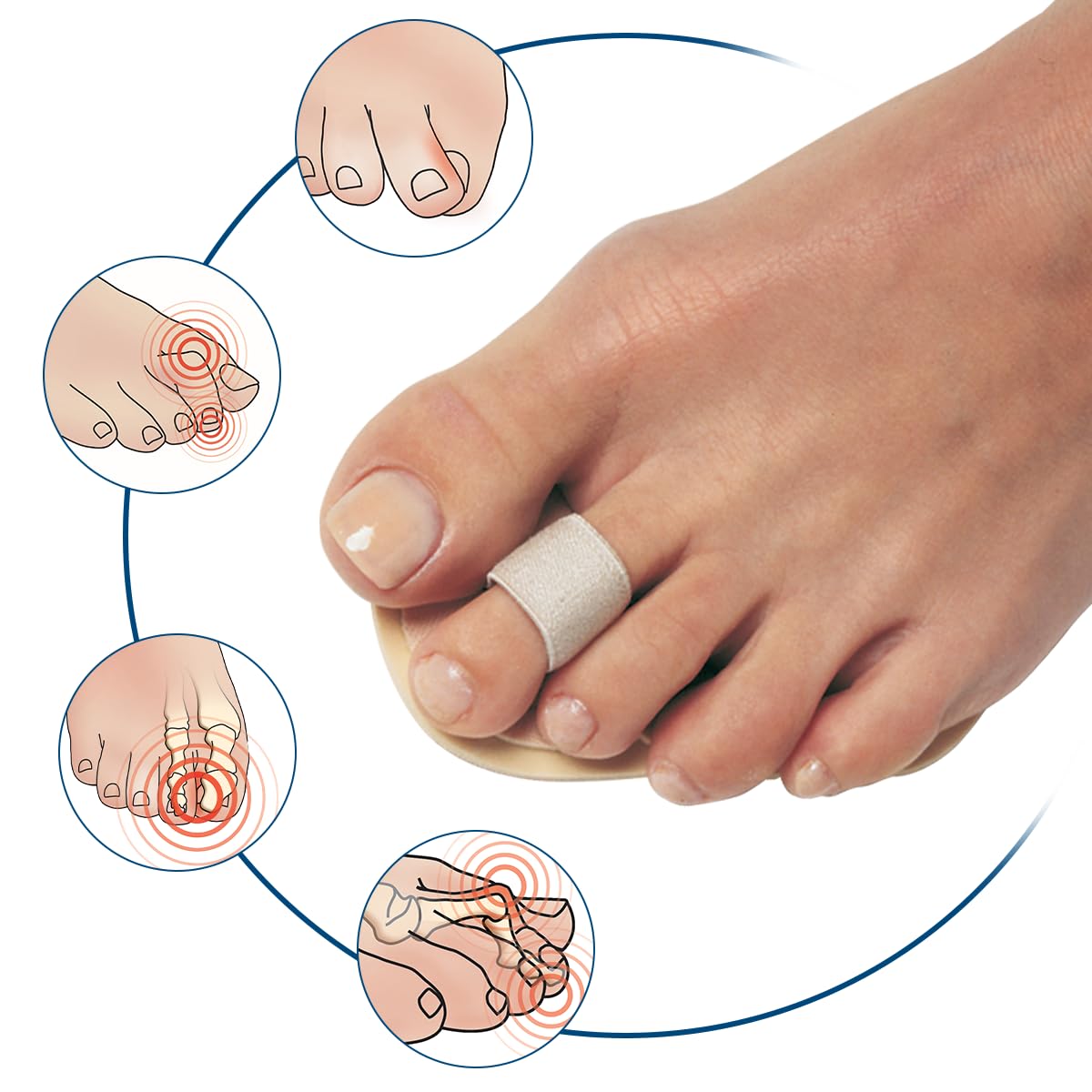PediFix Podiatrists' Choice Toe Straightener – 3-Pack Toe Aligners Gently Help Realign Crooked, Overlapping, and Hammer Toes – Designed for Comfort and Daily Relief – One Size Fits Most