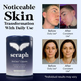Seraph Acne Supplement - Hormonal Acne Pills Treatment - Pimple Supplements for Women - Skin Care Supplement for Teen, Men, & Adults - Made in USA - 60 Tablets