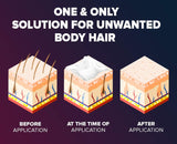 Epify Hair Removal Cream, Intimate Private Hair Removal Cream for Men and Women, Private Area, Pubic & Bikini Hair Removal Cream, Sensitive Skin, 8.45 Fl Oz