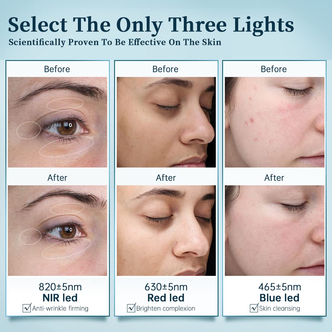 GYH 8-Color LED Face Mask Light Therapy, Red Light Therapy for Face, FSA/HSA Eligible, Wireless High Dose Green, Blue, Infrared Light Therapy Mask for Skin Care & Anti-aging, Cloud-SSS (RB-080)