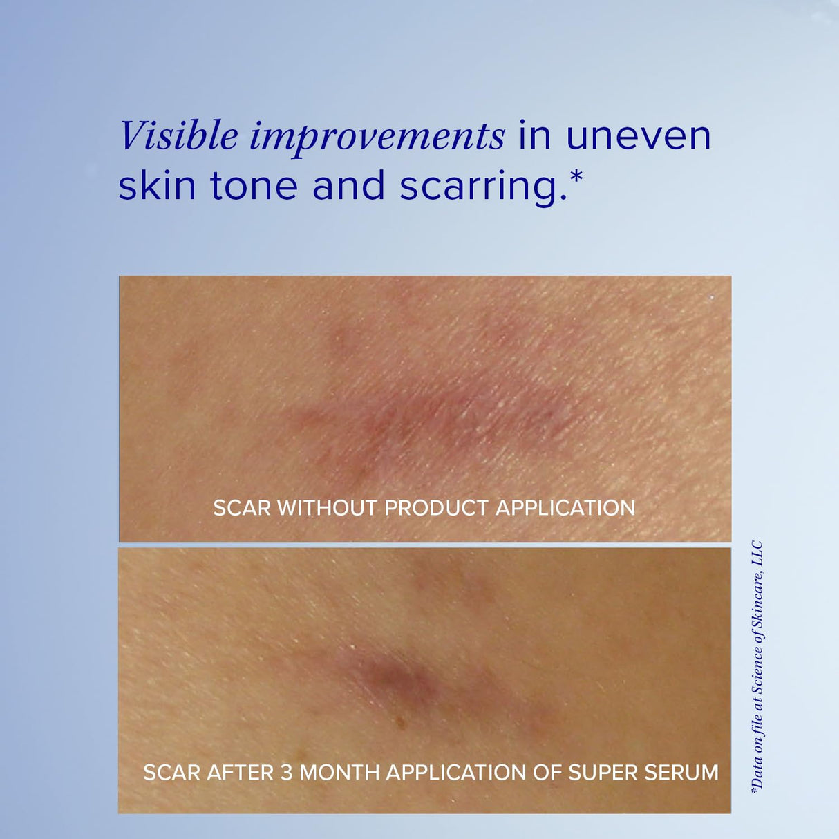 iS CLINICAL Super Serum Advance+, Anti-Aging Vitamin C Face Serum, reduces scaring and fine stretch marks, 1 Fl Oz