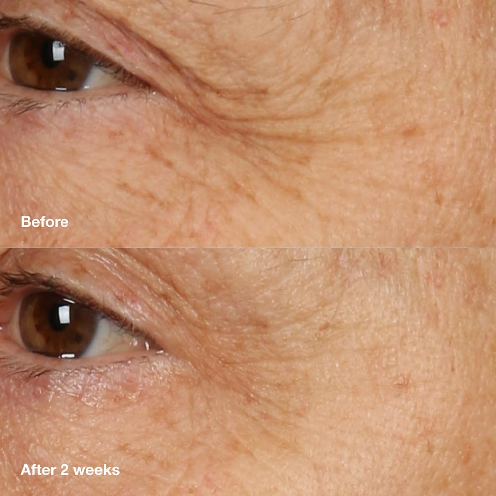 Clinique Smart Clinical Repair Overnight Recovery Cream + Mask, 1.7 Fl Oz