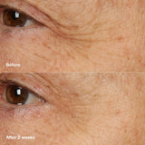 Clinique Smart Clinical Repair Overnight Recovery Cream + Mask, 1.7 Fl Oz