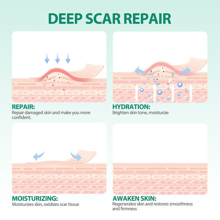 Medical Grade Silicone Scar Sheets (1.6” x 120” Roll - 3M), Professional Silicone Scar Tape, Reusable Silicone Scar Strips, Scar Remove Treatment for Acne Scars C-Section & Keloid Surgery