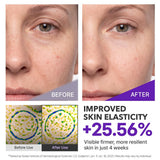 CENTELLIAN 24 Expert Madeca Cream Active Renew PDRN, TECA, Firming
