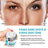 Dark Spot Remover for Face, Fast-Acting Dark Spot Corrector Remover for Face and body Hyperpigmentation, Fades Melasma, Freckle, Sun Spots, Evens Skin Tone, Age Spot Remover for Women Men
