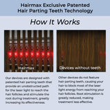 Hairmax LaserBand 82 - Hair Growth and Regrowth Treatment - Restores Natural Hair Cycle - Home-Use Medical Device With Medical Grade Lasers