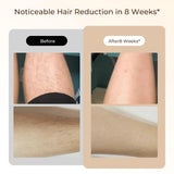 Laser Hair Removal, Laser IPL Hair Removal for Women and Men Permanent, Hair Removal Device with 3.0 IPL Red Light Wave, Home Laser Hair Removal Device for Legs Armpits Back Bikini Body Use