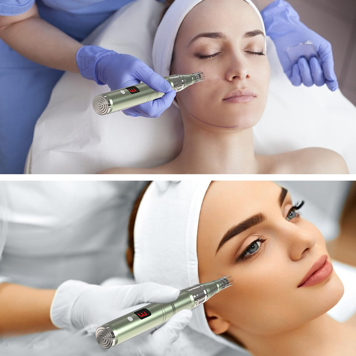 Home Use 0.25mm Beauty,Derma Roller kit- 0.25 mm