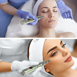 Home Use 0.25mm Beauty,Derma Roller kit- 0.25 mm