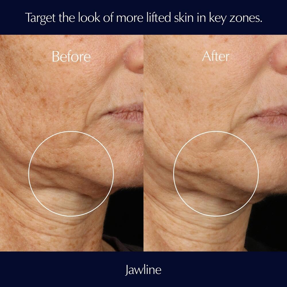 Estée Lauder Perfectionist Pro Rapid Firm + Lift Serum with Hexapeptides 8 + 9, 1 Fl Oz