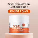 Acne Treatment Cream for Face & Body - Anti-acne Moisturizer for Teens & Adults - Spot Treatment for Breakouts & Blemishes - 30g
