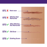 Silicone Scar Gel Scar Cream: SPF 30 Advanced Medical-Grade Formula for Surgical Scars, C-Section, Stretch Marks, Acne, Burns, Keloids, Old & New Scars – Broad Spectrum UV Protection 1.06oz (30g)