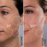 Michael Todd Beauty - Sonicsmooth Pro+ Dermaplaning Blade Refills - 8 Dermaplaning Blades- 2 Month Supply - Device Not Included