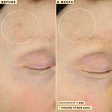 Farmacy 10% Vitamin C Face Serum - Waterless Vitamin C Skin Care Serum to Brighten, Firm + Smooth Skin Texture - Enriched with Upcycled Tangerine Peel to Boost Skin's Moisture + Radiance (30ml)