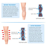 20-30mmHg Compression Pantyhose for Women, Medical Compression Stockings, High Waist Opaque Compression Tights for Lymphadema Edema, Swelling, Varicose Veins, Support Hose for Teacher Doctor (L,