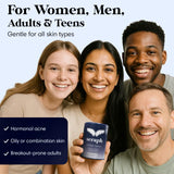 Seraph Acne Supplement - Hormonal Acne Pills Treatment - Pimple Supplements for Women - Skin Care Supplement for Teen, Men, & Adults - Made in USA - 60 Tablets