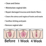 AnnieCare Instant Anti-Itch Detox Slimming Products,Annie Care Capsulas, Firming Repair & Pink and Tender Natural Capsules (2PCS)