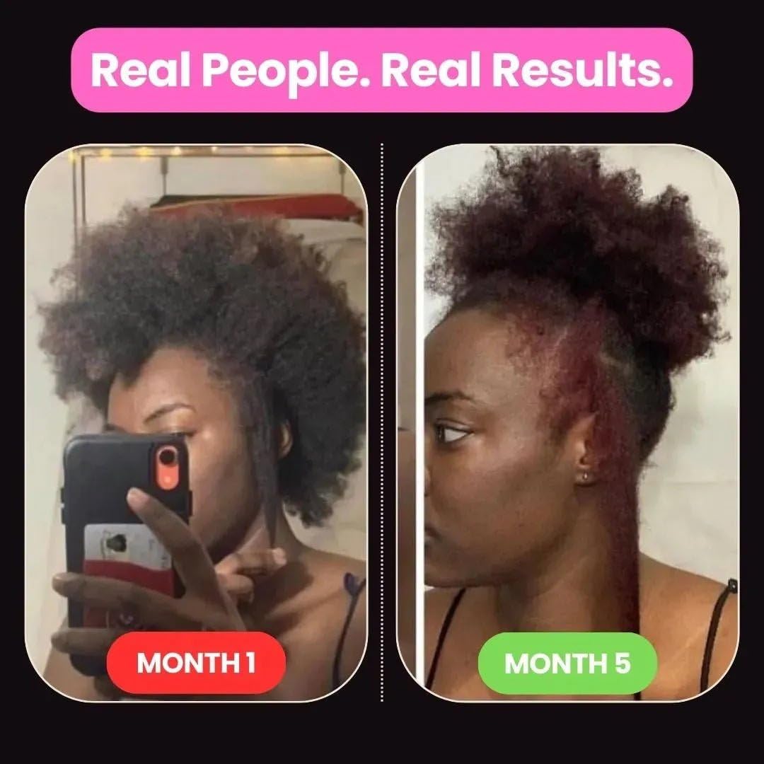 10 in 1 Hair Growth Oil (2 Oz) | Formulated With African Chebe Powder For Extreme Hair Growth, 2 Fl Oz (Pack of 1), 2.0 ounces