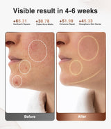 JOVS Red Light Therapy Mask for Face, LED Face Mask Light Therapy with Near-Infrared Red Light, 4 Modes and Portable Skin Care Tools for Home Use