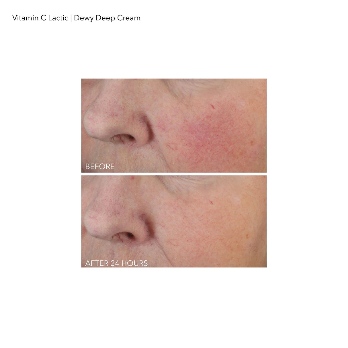 Dr Dennis Gross Vitamin C Lactic Dewy Deep Cream: Ultra-Rich, Replenishing Cream for a Dewy Finish, 2 oz