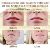 FRANDORA Beef Tallow & Honey Balm – All-Natural Moisturizer Hydrates and Nourishes the Skin, Grass-fed Beef Tallow Honey Balm blend - Ultra-Nourishing Moisturizer for Face, Body & Hands.