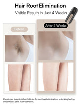 Laser Hair Removal Device for Women and Men, INIA Fond Hair Remover with Long-Lasting in Hair Reduction for Body&Face, Safe at-home Results for Armpits, Bikini and Legs