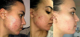 Retinol Gel 0.1 Vitamin A Repairs Fine Lines & Wrinkles, Scar Treatment, Age and Sun Spots, Anti-Aging Formula, 20 Grams