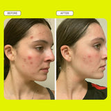 Evereden Preppy Skincare Collection with Triple Green Tea: Teen Skincare Steer Clear Balancing Jelly Cleanser Teen Face Wash, Let's Bounce Gel-Cream Moisturizer, & Balance Up Toner Pads for Face