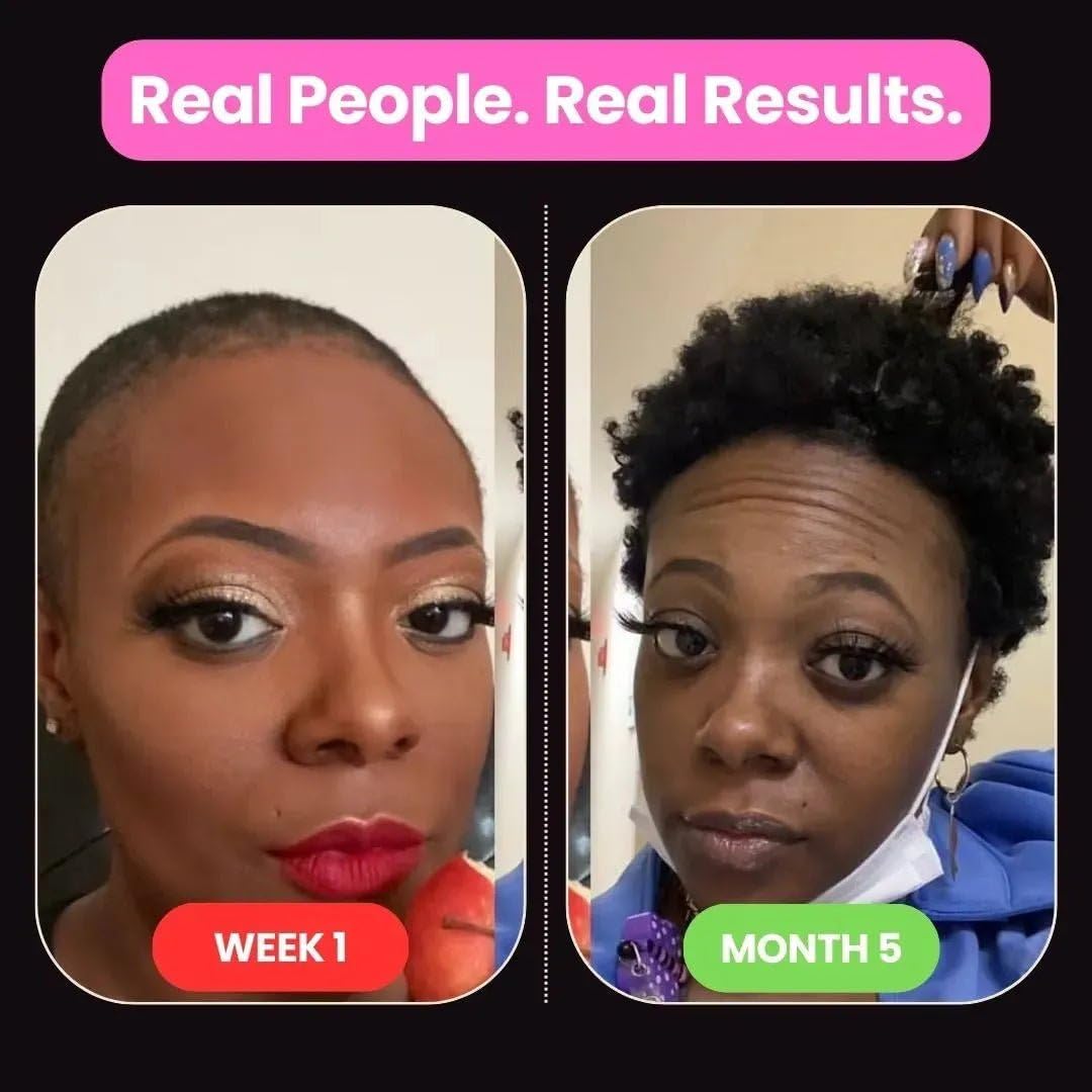 10 in 1 Hair Growth Oil (2 Oz) | Formulated With African Chebe Powder For Extreme Hair Growth, 2 Fl Oz (Pack of 1), 2.0 ounces