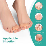 Welnove Pack of 12 Bunion Corrector