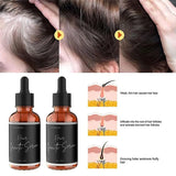 FIONEL Allurium Hair Growth Serum Designed for Black Women with Herbs and Natural Vitamin (4 Pack)