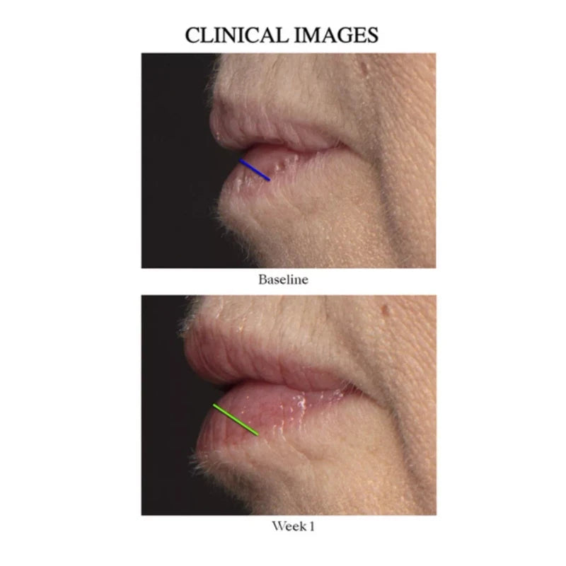 NuSkin Nu Skin Nu Colour Peptide Pout New Sealed