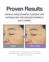 Centellian 24 360º Shot PDRN Active Serum (1.69fl oz) - Intense Hydration & Skin Firming Serum for a Youthful Appearance, Korean Skin Care. PDRN, Ribbon Collagen & Hyaluronic Acid