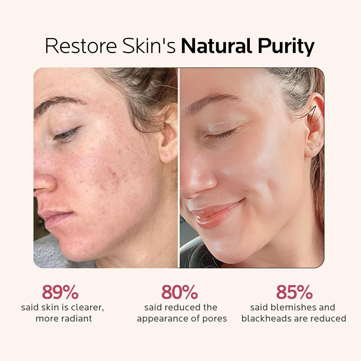 Facial Steamer Self-Care Gift Kit: Nano Ionic Face Steamer Deep Cleaning Unclogs Pores - Home Sauna Spa Humidifier Hot Mist for Women Men Sinus Moisturizing (Rose Gold)