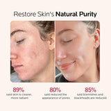 Facial Steamer Self-Care Gift Kit: Nano Ionic Face Steamer Deep Cleaning Unclogs Pores - Home Sauna Spa Humidifier Hot Mist for Women Men Sinus Moisturizing (Rose Gold)