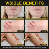 KZUO Beef Tallow for skin, Beef Tallow, Hydrating Tallow Balm with Raw Honey and Beeswax, Grass-Fed Beef Tallow & Raw Wild Honey Blend, Body & Face Moisturizer, Natural Formula