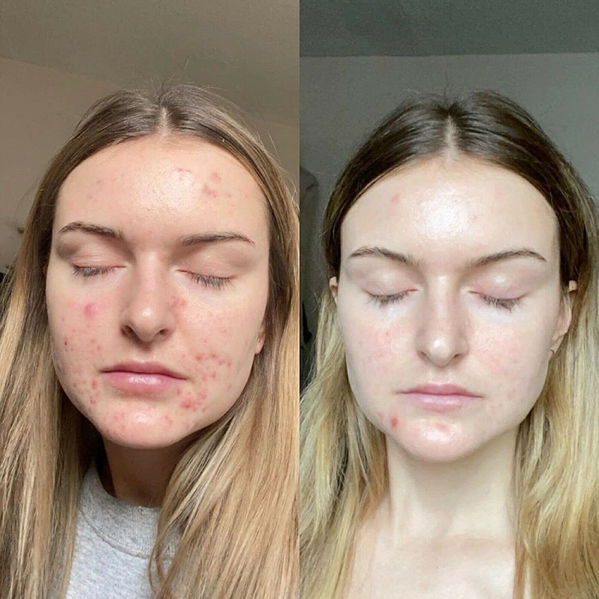 Retinol Gel 0.1 Vitamin A Repairs Fine Lines & Wrinkles, Scar Treatment, Age and Sun Spots, Anti-Aging Formula, 20 Grams