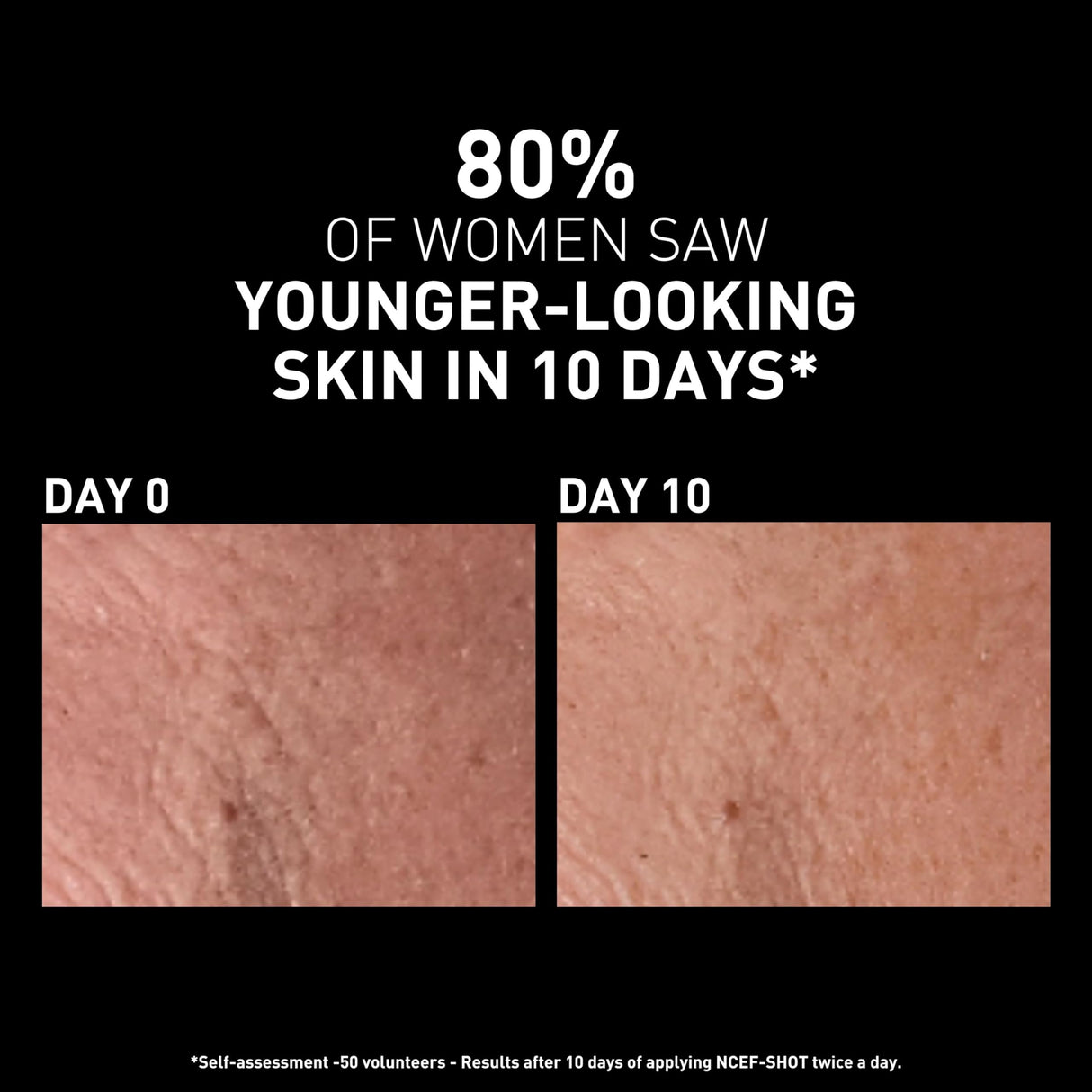 Filorga NCEF-Shot Anti-Aging Serum, Concentrated Wrinkle Reducing Treatment for Radiant & Firm Skin in 10 Days, 0.5 fl. Oz.