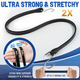 Bolvixor Bungee Cords with Hooks (10 Pack) – 10", 15", 21", 31" Heavy Duty EPDM Rubber Tarp Straps, Max Stretch 2X, Load 180+ LBS, Crimped S Hooks for Cargo, Trucks, Camping, Outdoor Use