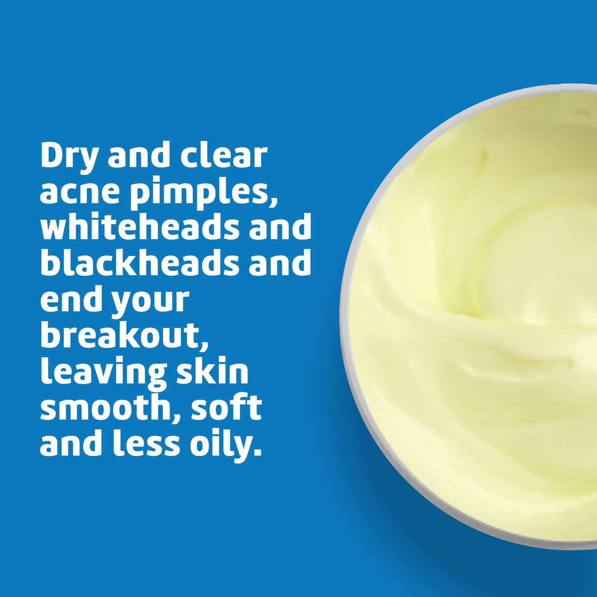 De La Cruz Sulfur Ointment - Cystic Acne Treatment for Face and Body - Daily 10 Min Spot Treatment Mask - Safe and Effective Game Changing Hormonal Acne Treatment that Clears Up Pimples - 2.6 OZ